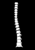 3D reconstruction of a spine